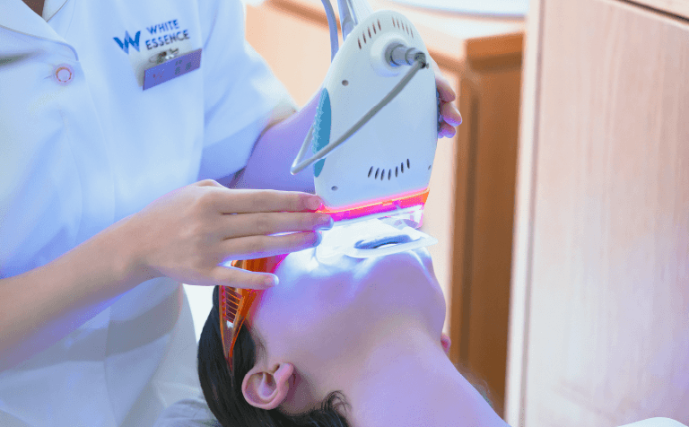 5つをチェック!オフィスホワイトニング材の選び方